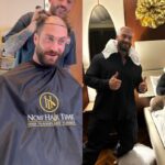 Chris Bumstead Hair Transplant 2